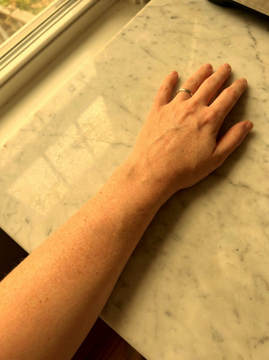 After, day 30, sun-kissed arms
