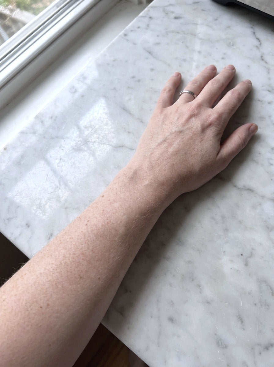 Before, day 0, fair arms